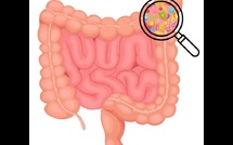 Le microbiome intestinal : une piste prometteuse pour la détection précoce de la maladie de Parkinson