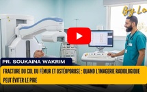 [vidéo] : Fracture du col du fémur et ostéoporose : quand l’imagerie radiologique peut éviter le pire