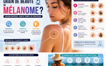 Comment distinguer un grain de beauté d’un mélanome ?