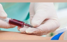 Analyses sanguines : ces habitudes quotidiennes peuvent fausser les résultats