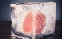 Une start‑up américaine affirme avoir réussi à préserver la structure du cerveau après la mort