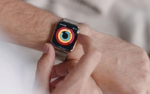 Apple Watch : vers une surveillance de la glycémie sans piqûre ?