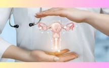 Cinq maladies gynécologiques silencieuses à ne pas négliger