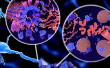 Alzheimer : une protéine naturellement présente dans le cerveau pourrait limiter les dommages liés à la maladie