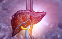 Cancer du foie : vers un nouveau traitement ?