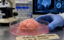 Des « mini-cerveaux » : la science vient-elle d’ouvrir une nouvelle porte sur notre cerveau ?