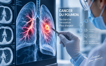 Cancer du poumon : derrière le spectaculaire taux de 94 %, une thérapie ciblée qui atteint aussi le cerveau
