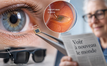 DMLA : enfin une puce capable de restaurer une partie de la vision perdue